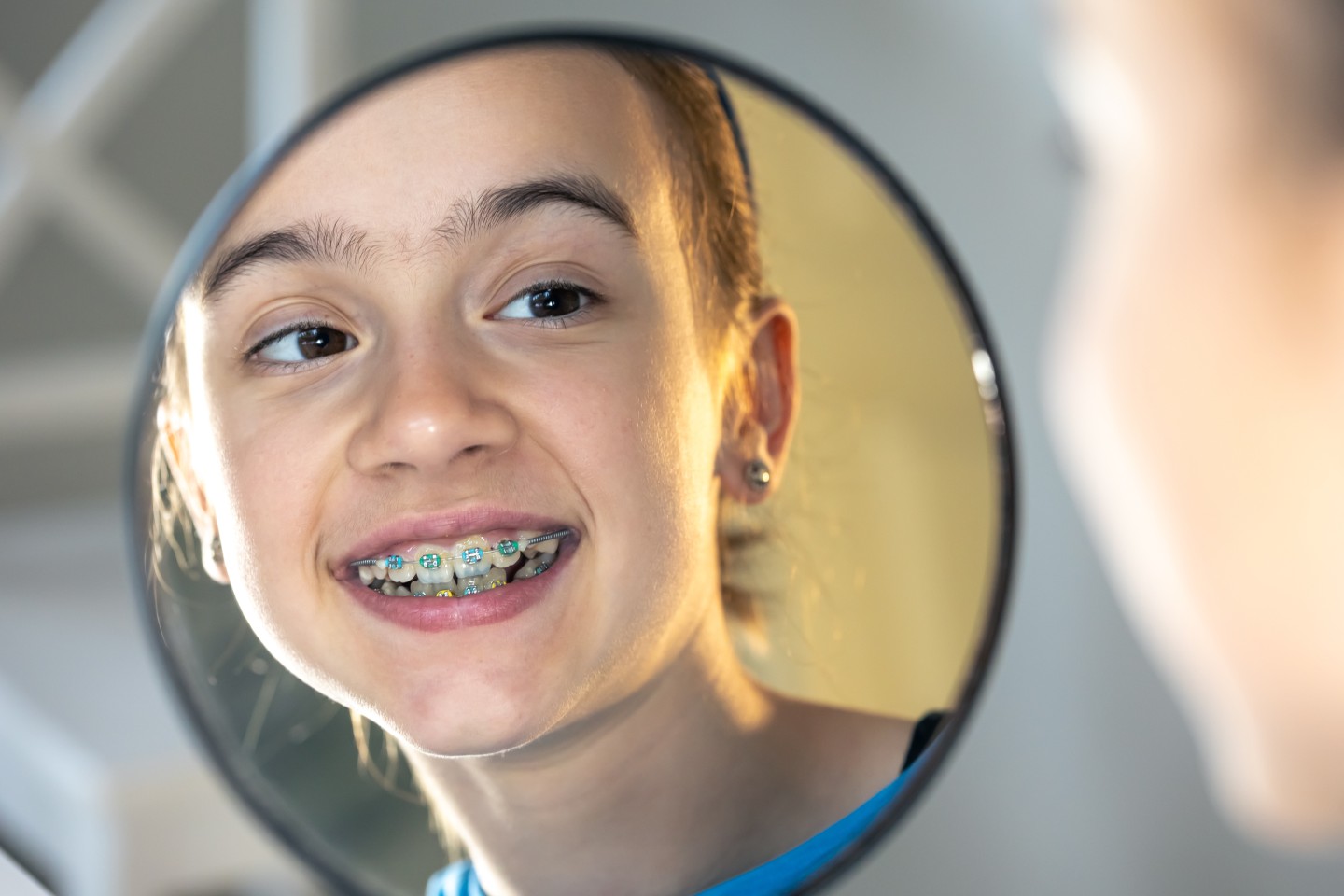Braces in New Hampshire